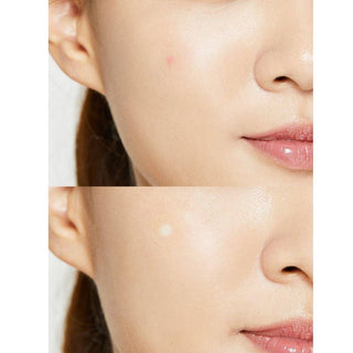 COSRX Acne Pimple Master 24 Patches 2